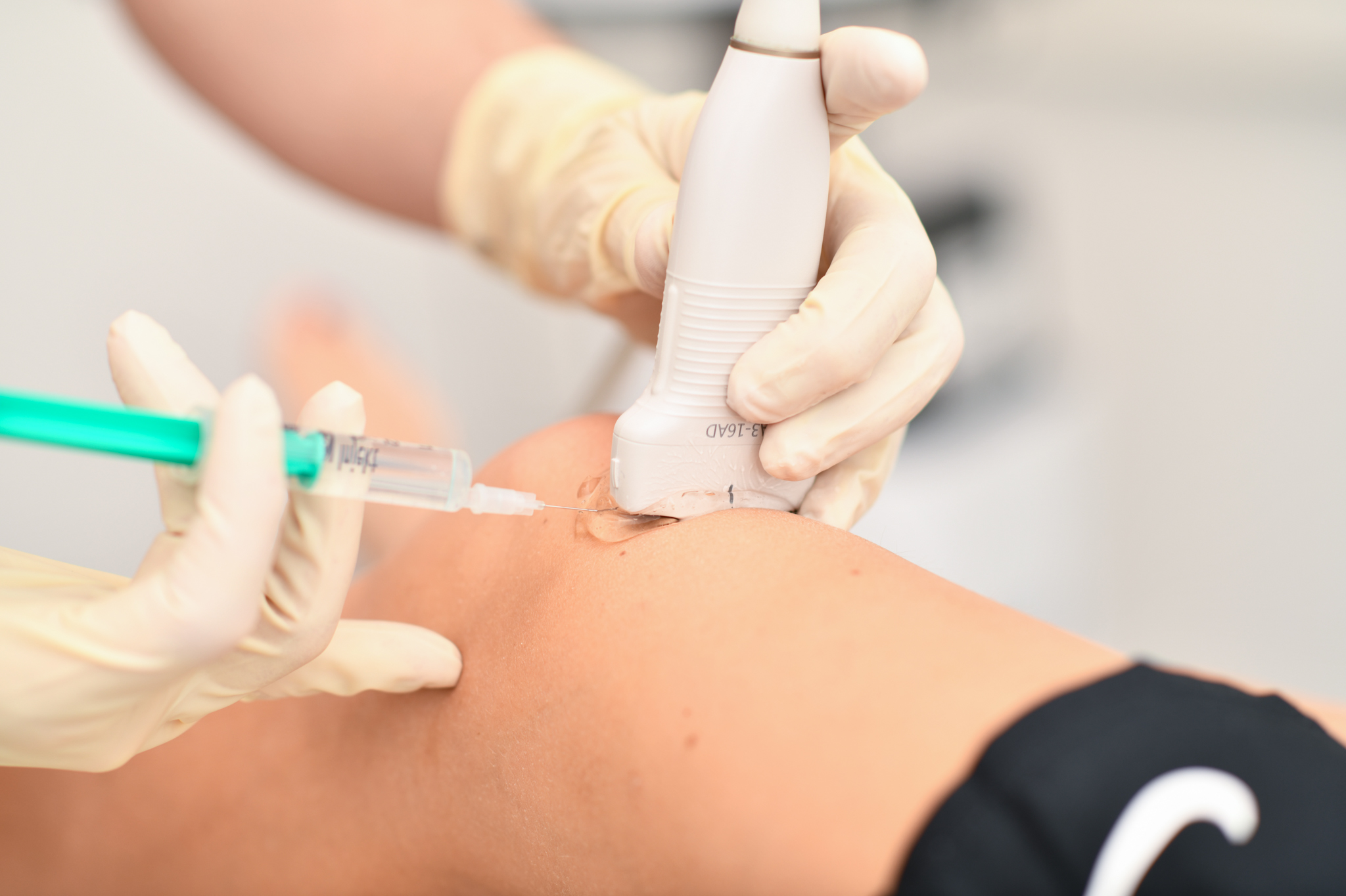 Dr. Treichler infiltriert in das linke Knie unter Ultraschallsicht