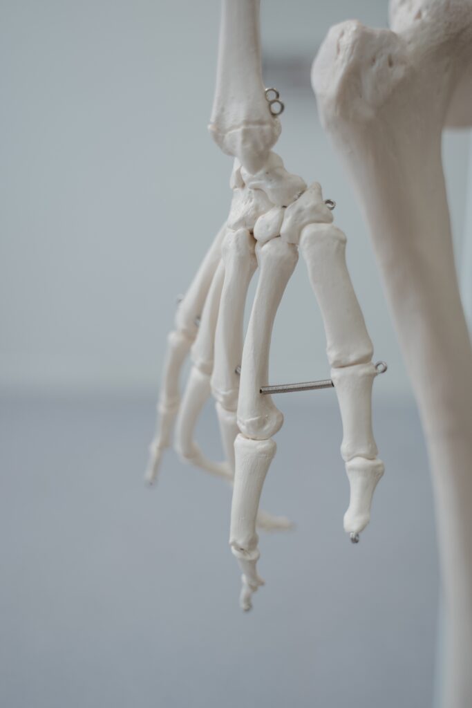 Skelett einer Hand als Sinnbild für Osteoporose